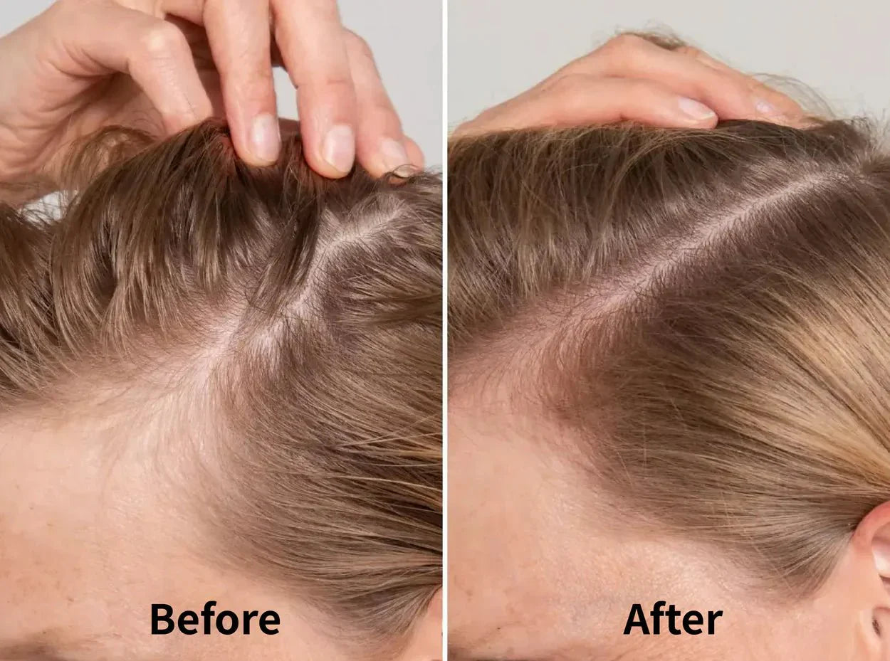 Scalp Massage comb - Montè™ - Montè